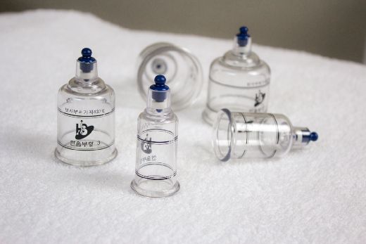 cupping cupping